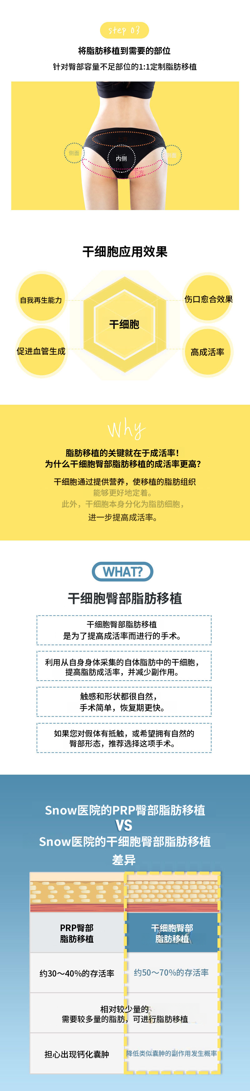 干细胞提臀自体脂肪移植