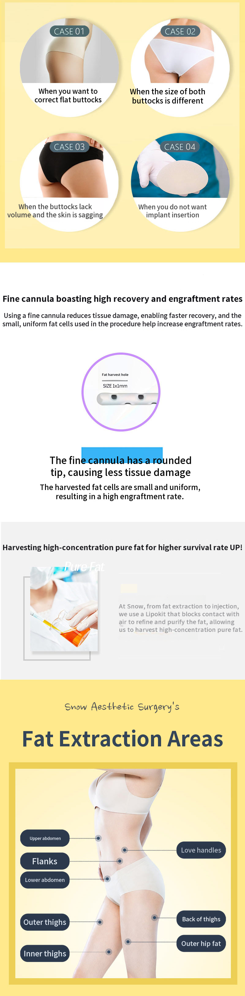 Stem Cell Butt Lift Fat Grafting