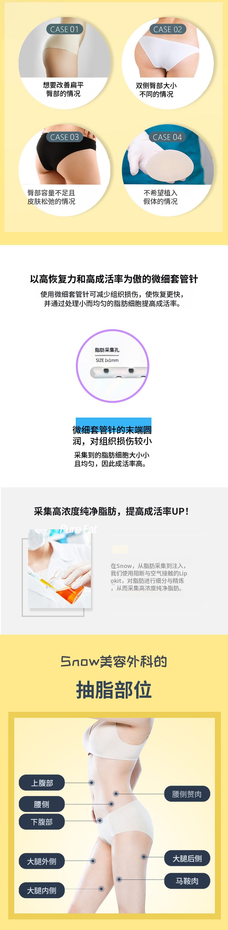 干细胞提臀自体脂肪移植
