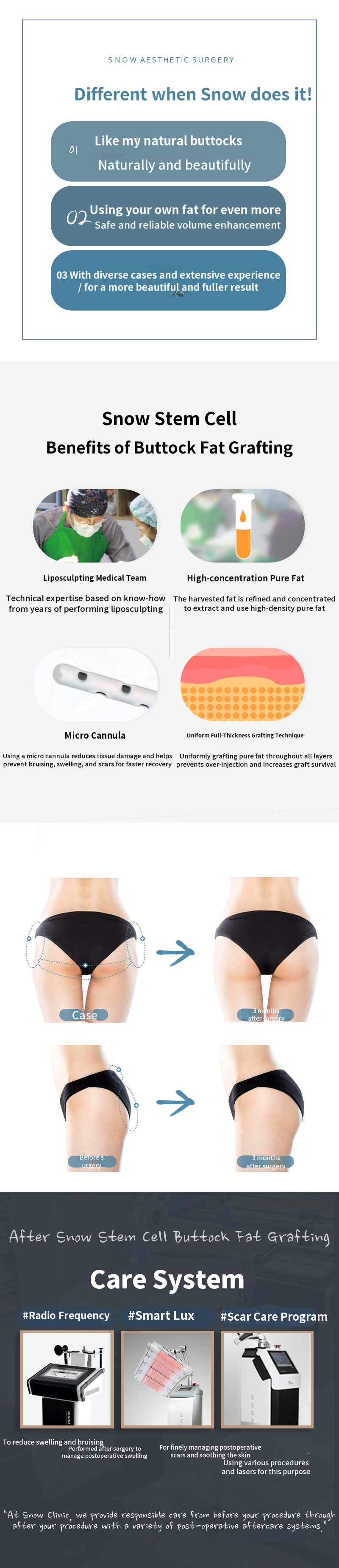 Stem Cell Butt Lift Fat Grafting