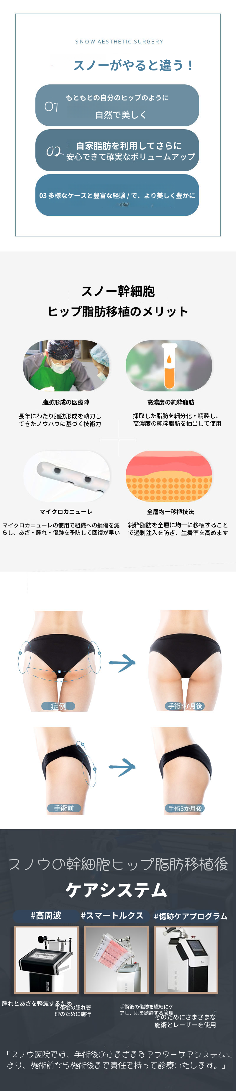 幹細胞ヒップアップお尻脂肪移植