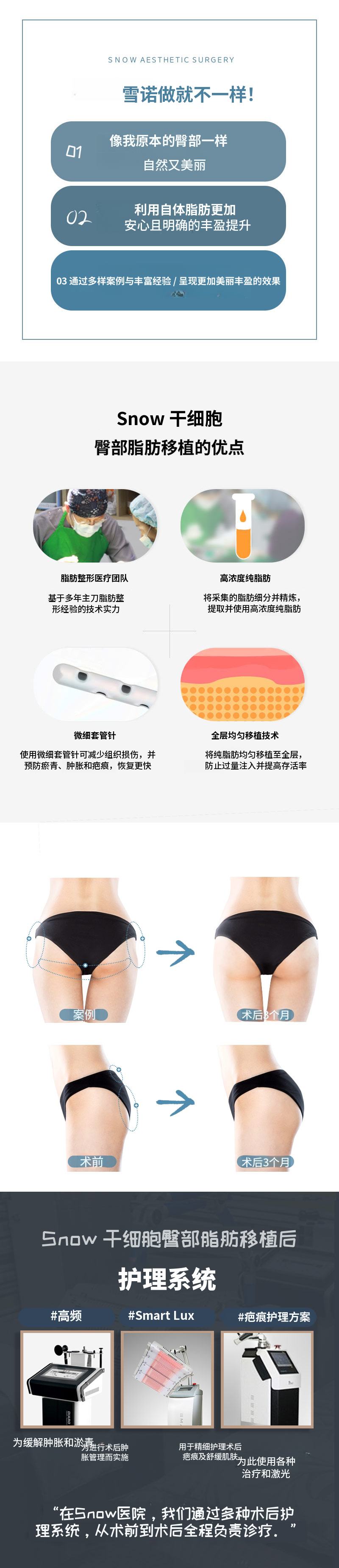 干细胞提臀自体脂肪移植
