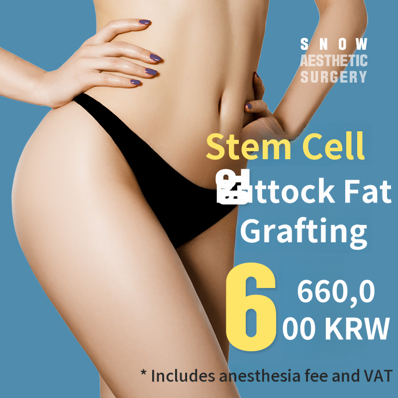 Stem Cell Butt Lift Fat Grafting