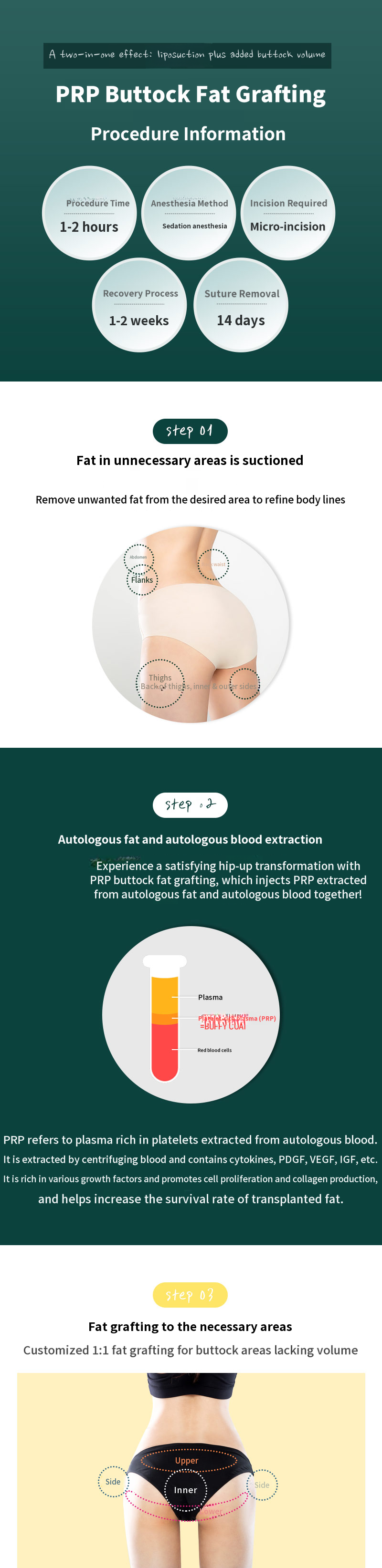 Hip Up PRR Buttock Fat Grafting