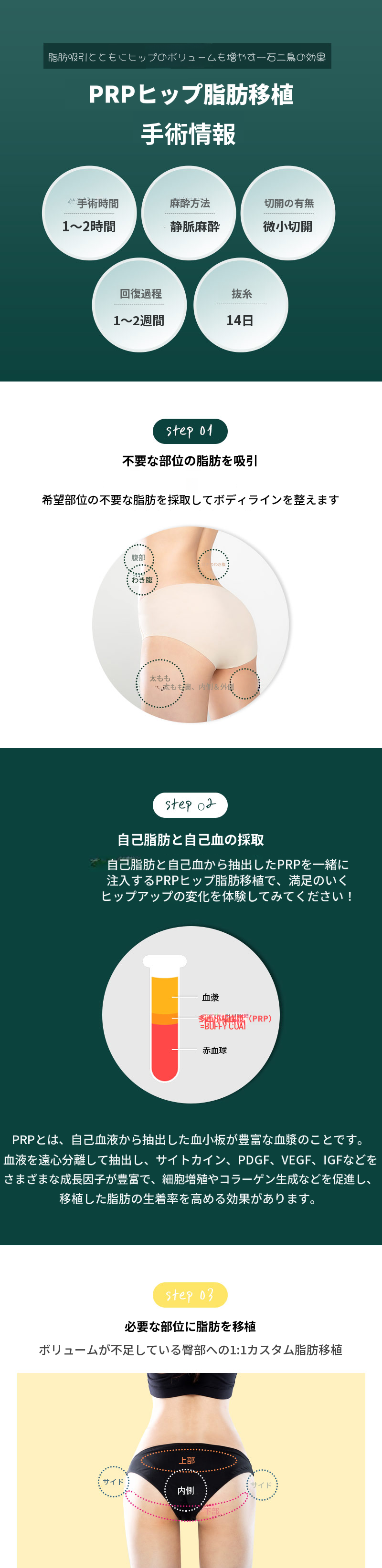 ヒップアップPRR お尻脂肪移植
