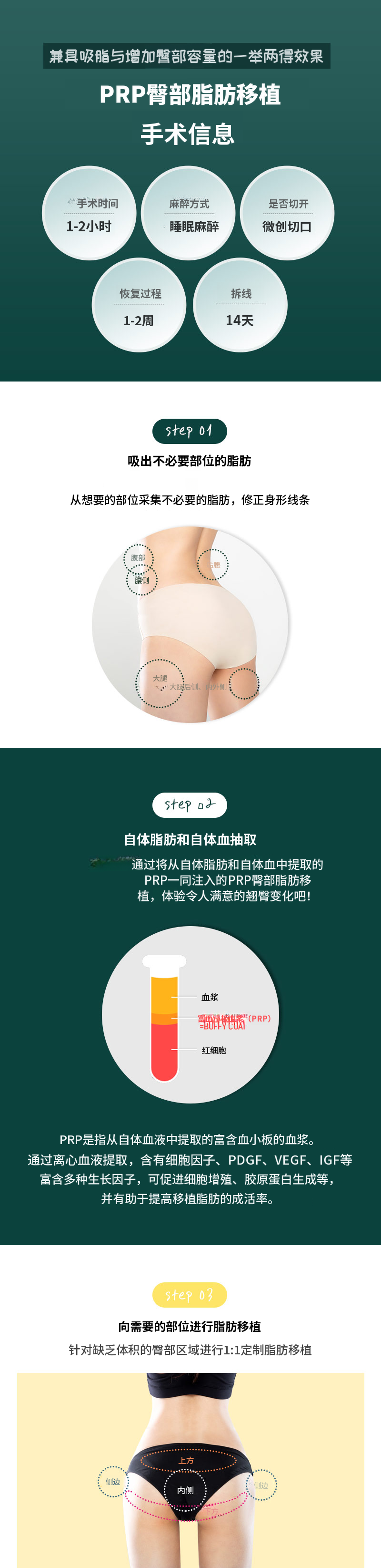 提臀PRR脂肪移植