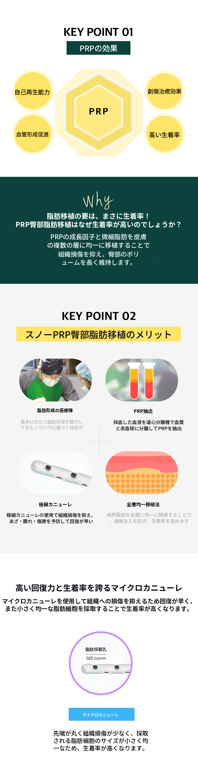 ヒップアップPRR お尻脂肪移植