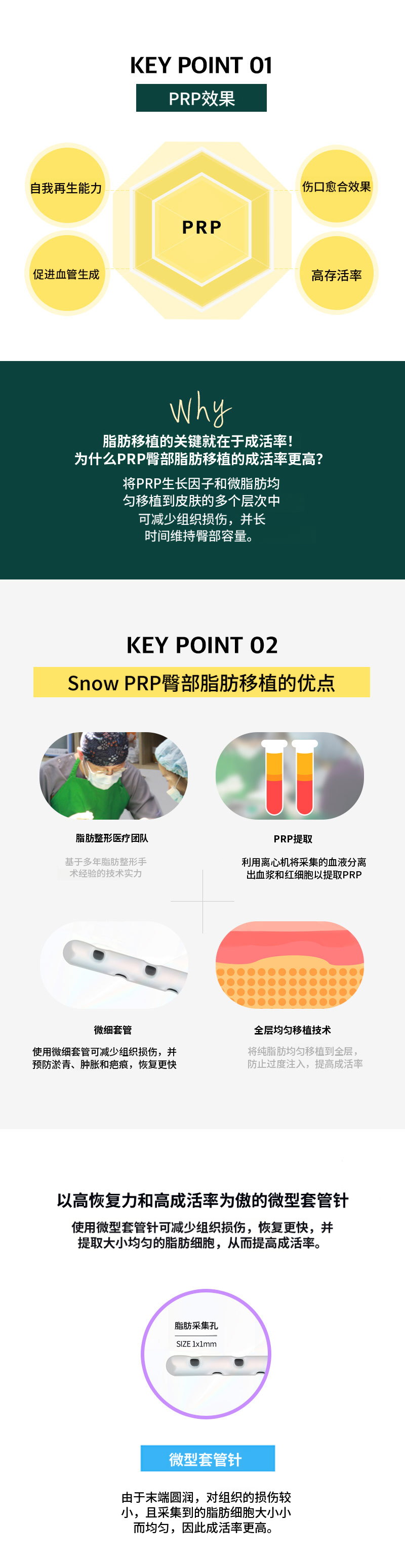 提臀PRR脂肪移植
