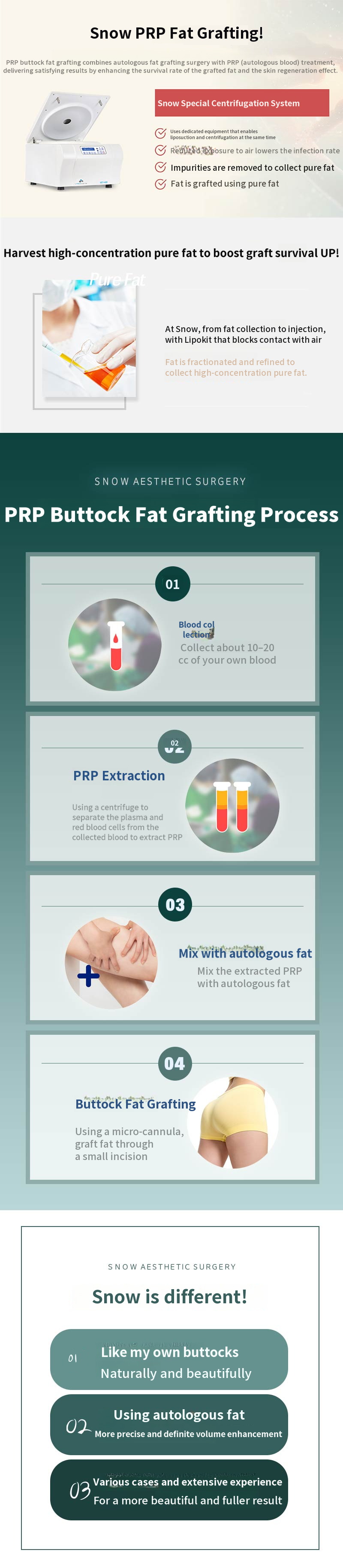 Hip Up PRR Buttock Fat Grafting