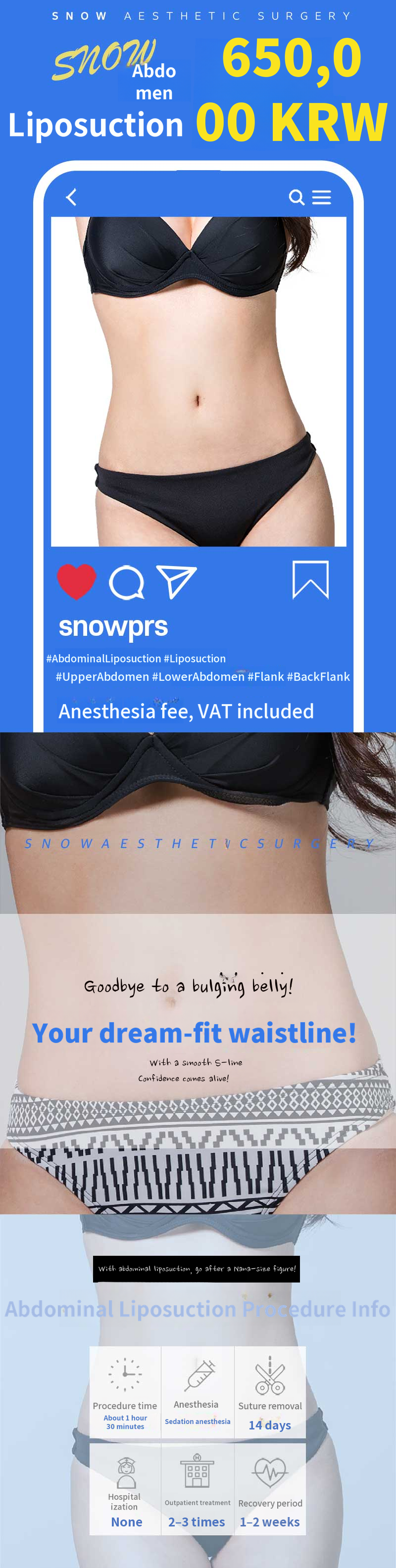 Large Volume Abdominal Liposuction