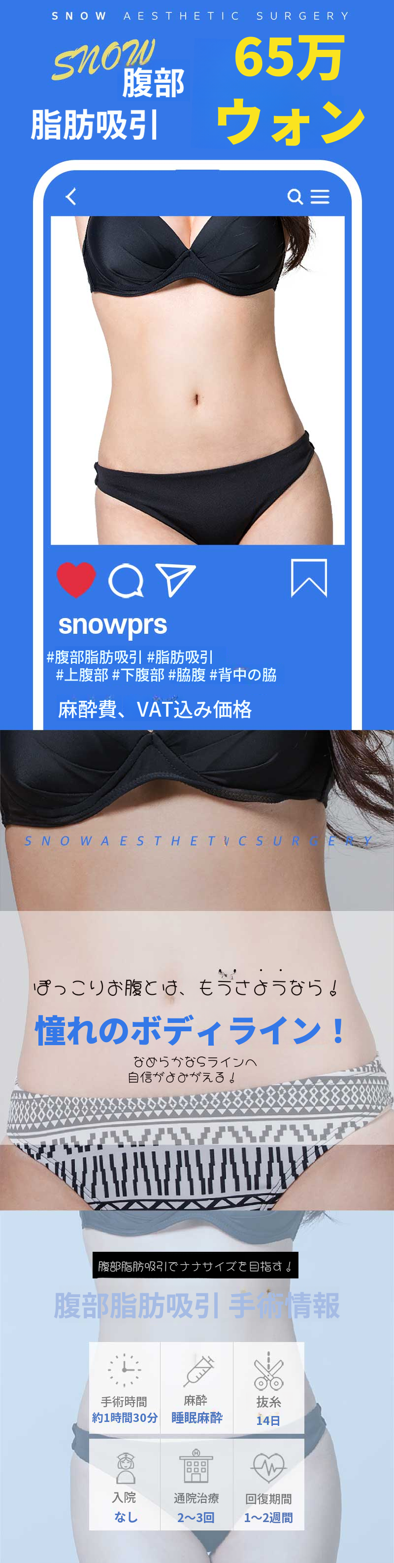 大容量腹部脂肪吸引