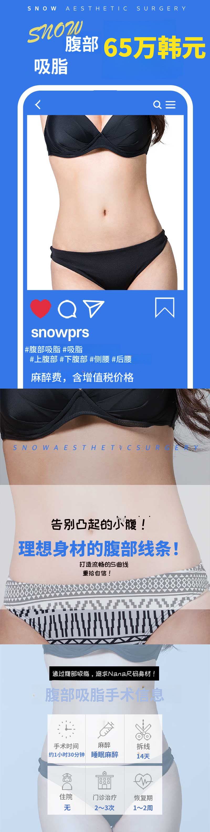 大容量腹部抽脂