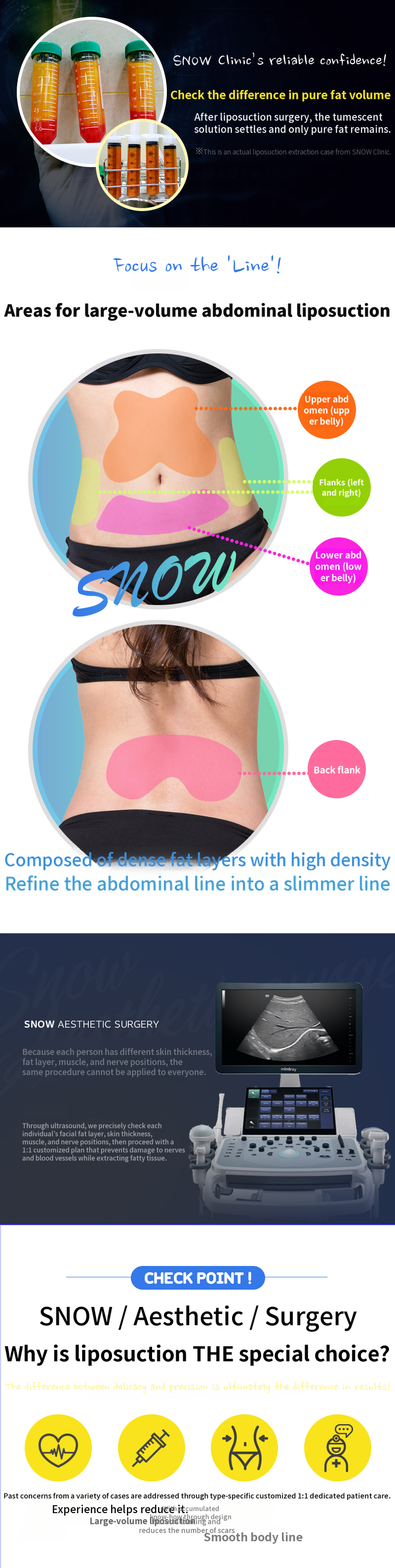 Large Volume Abdominal Liposuction