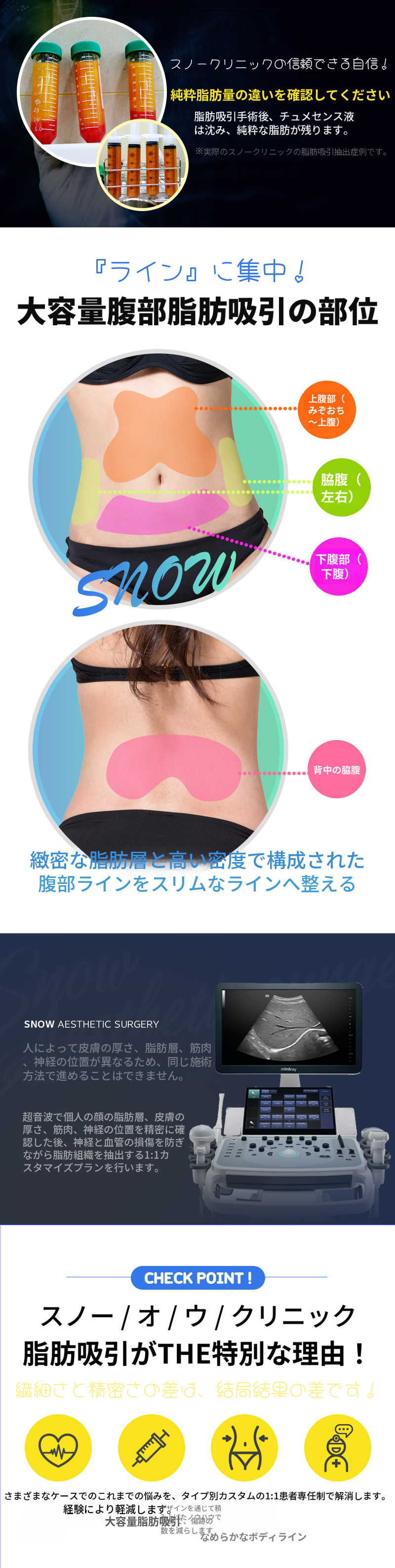 大容量腹部脂肪吸引