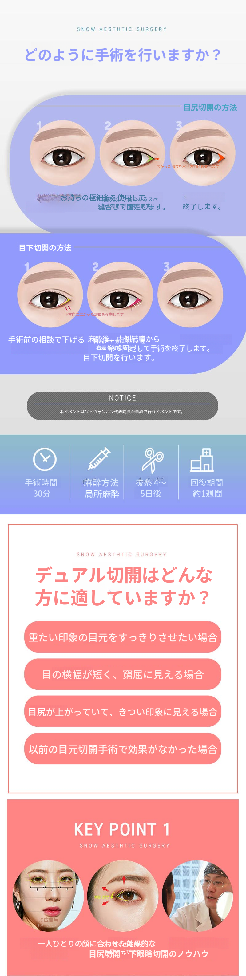 デュアル切開、爽やかで生き生きとした