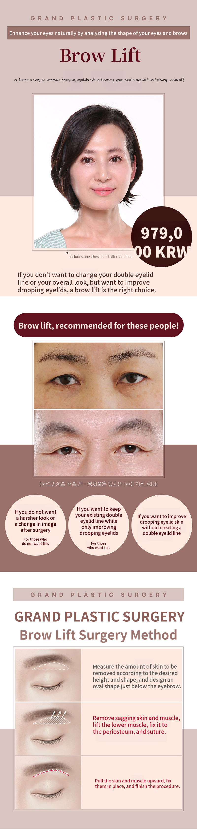 Eyebrow Lifting Surgery for Droopy Eyelids Improvement