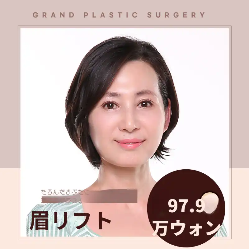 眉毛引き上げ術 たるんだまぶた改善