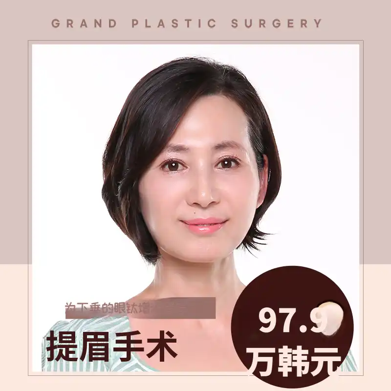眉毛提升术改善下垂眼睑
