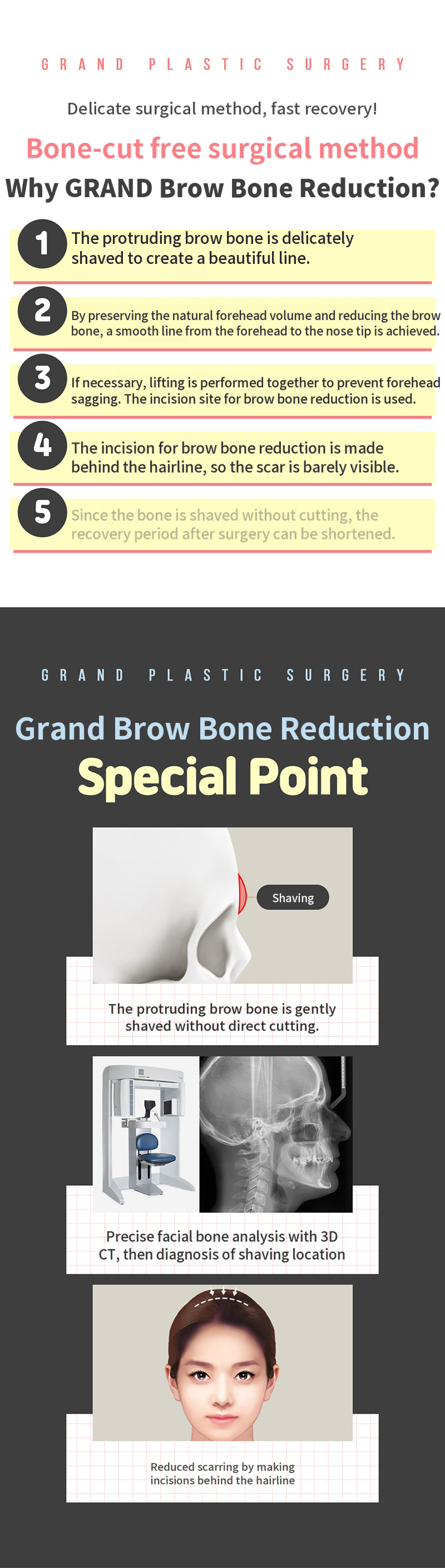 Soft Forehead Line and Eyebrow Bone Reduction