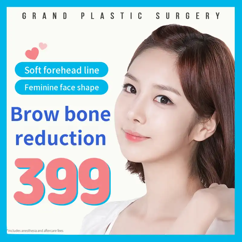 Soft Forehead Line and Eyebrow Bone Reduction