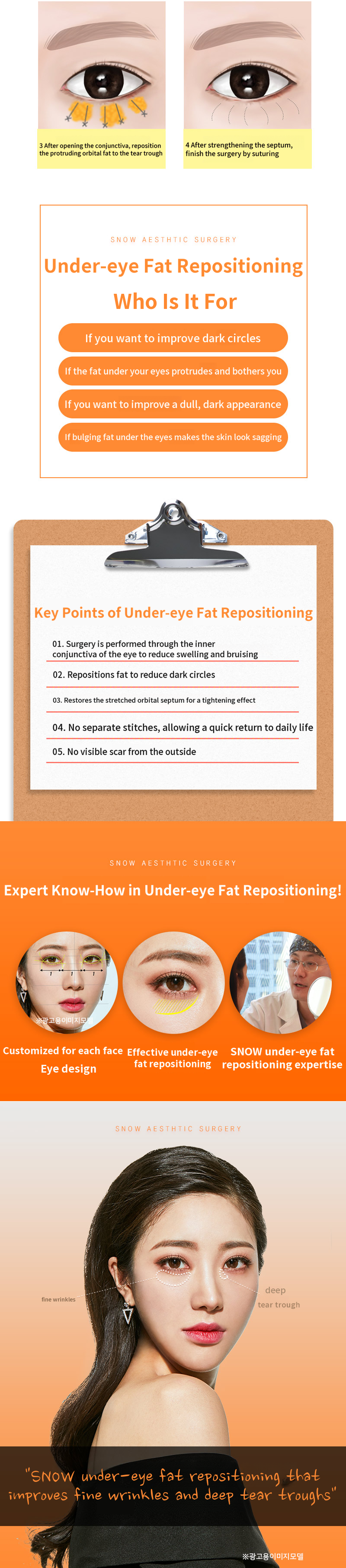 Snow Lower Eyelid Fat Repositioning