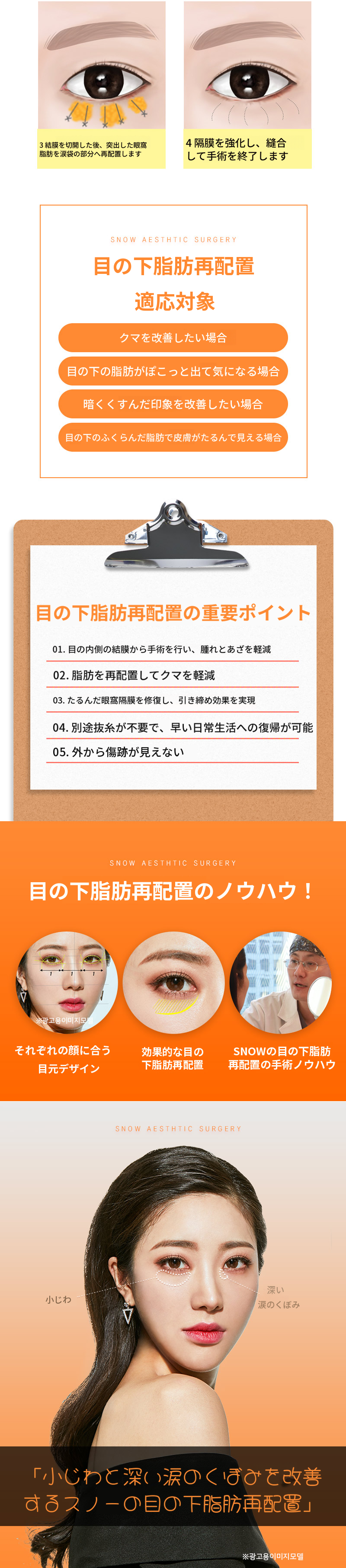 スノー下まぶた脂肪移動