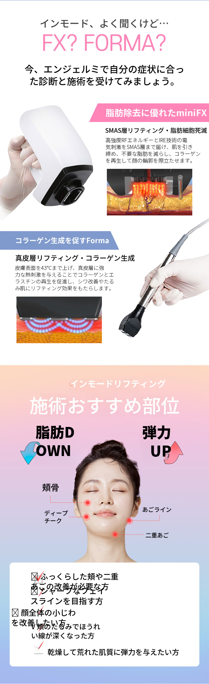 インモードリフティング