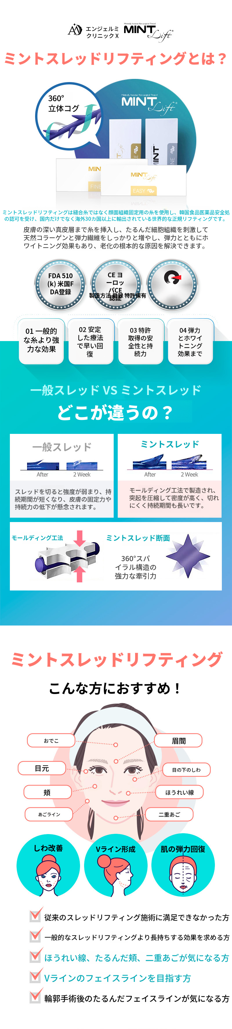 ミント糸リフティング