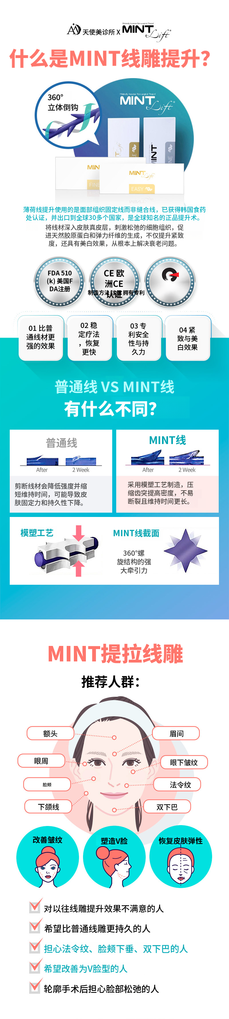 薄荷线提升