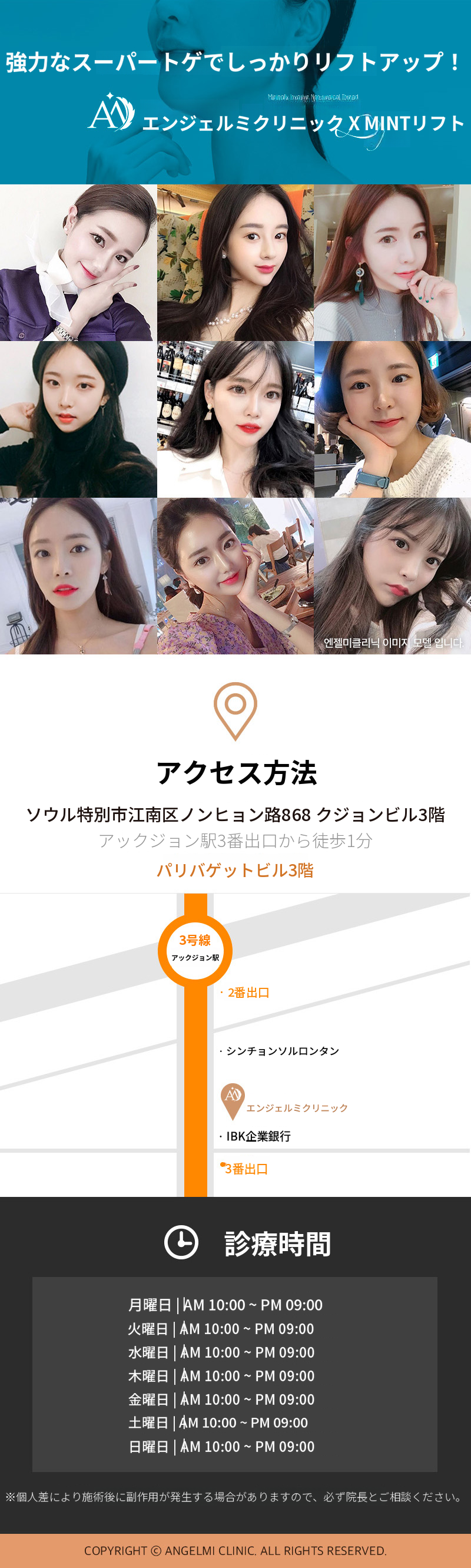 ミント糸リフティング