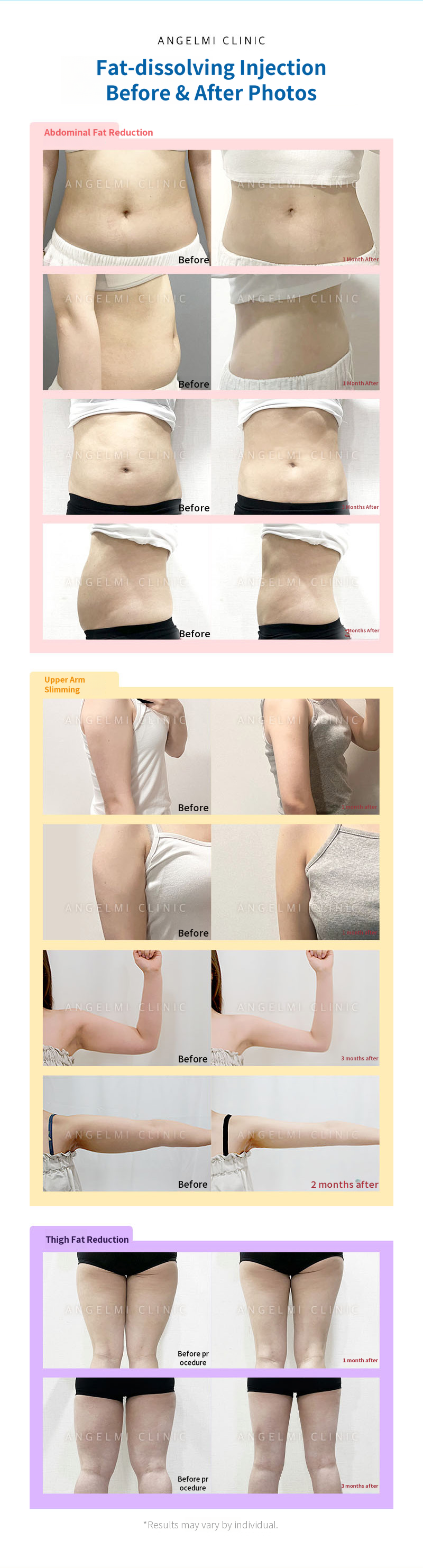 Large Volume Weight Loss Injection