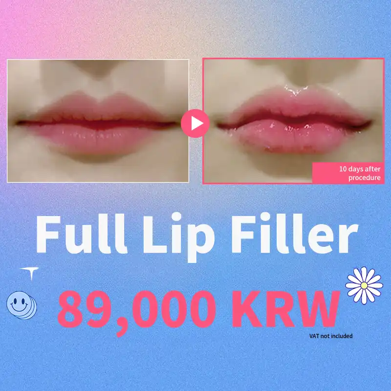 Full Lip Filler