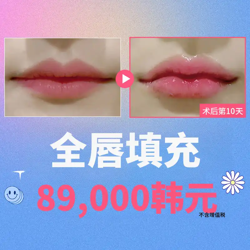 唇部全填充