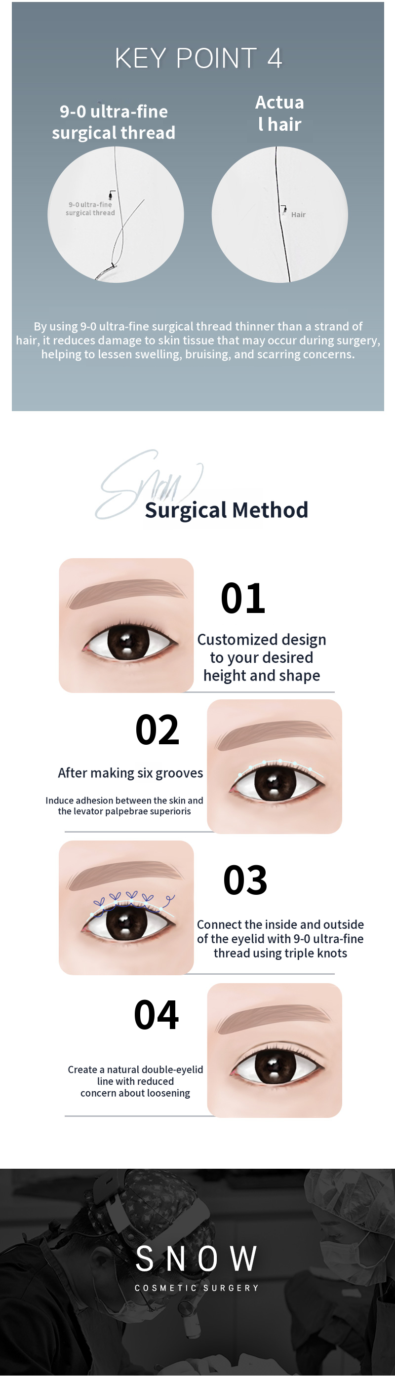 Secret Eye Surgery Revision