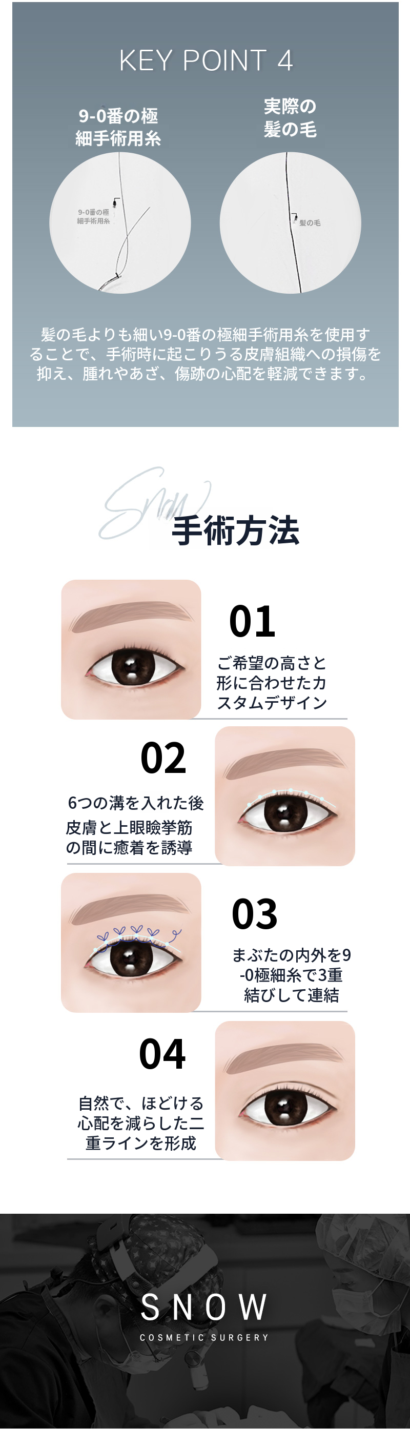 秘密の目整形 埋没再手術