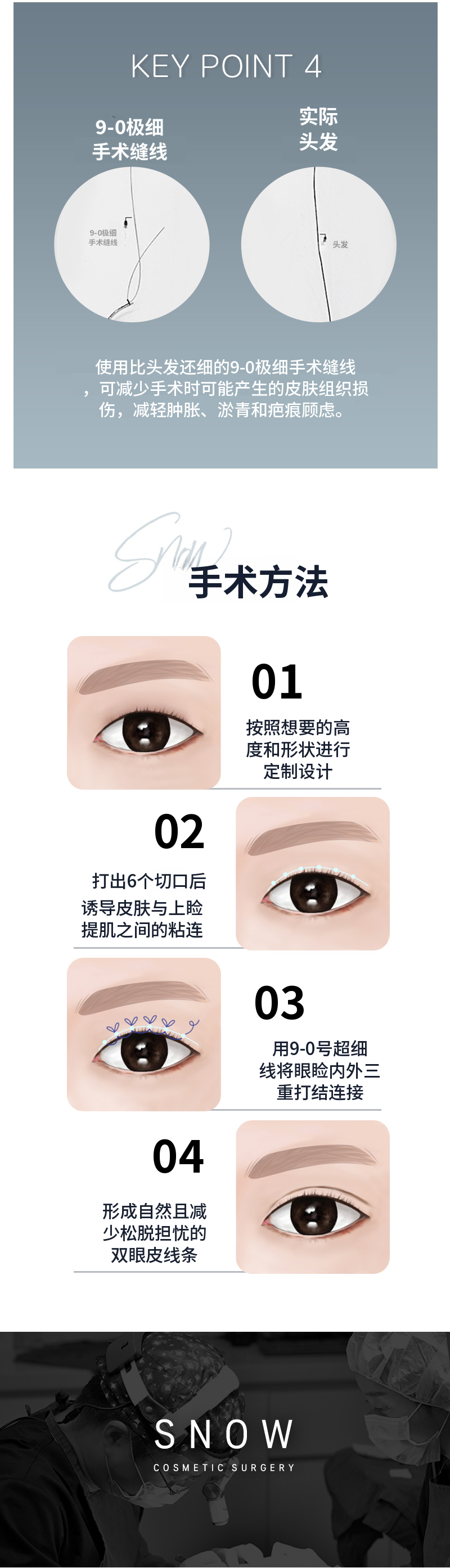秘密眼部整形埋线修复手术