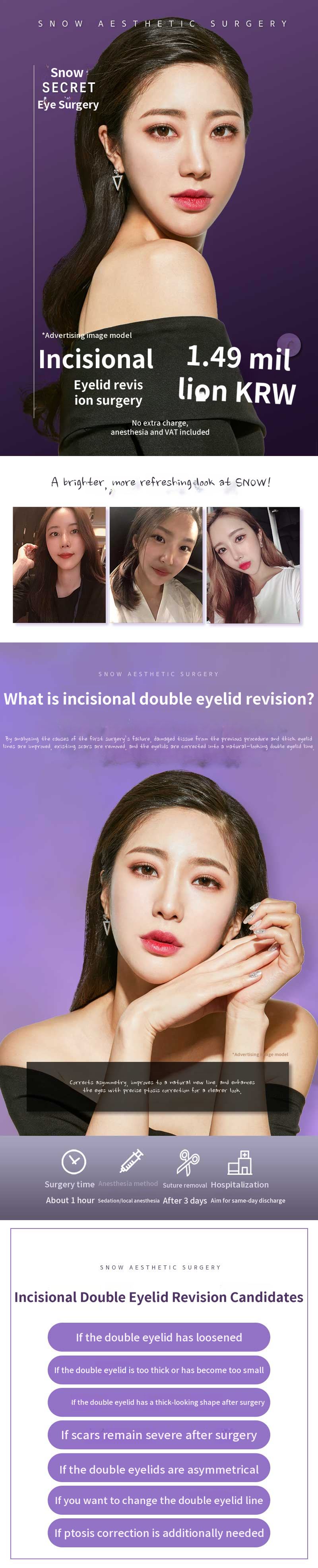 Secret Eye Surgery Revision Surgery