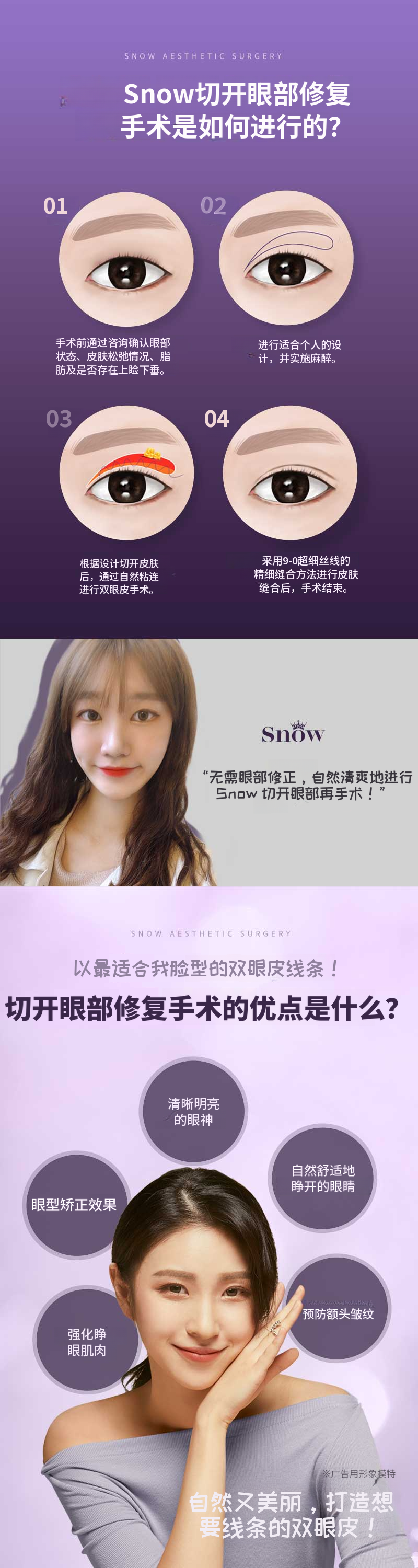 秘密眼部整形切开术再手术
