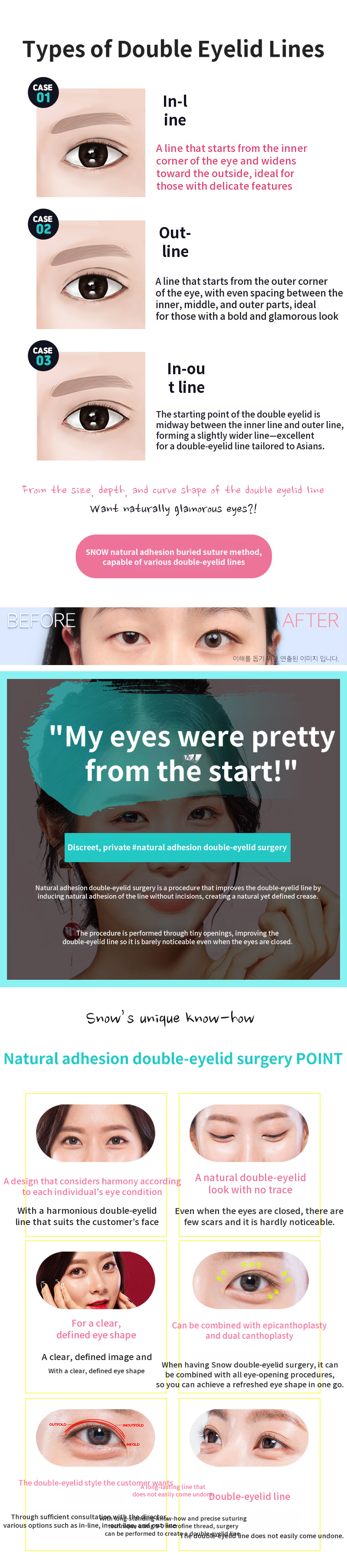 Natural adhesion double eyelid