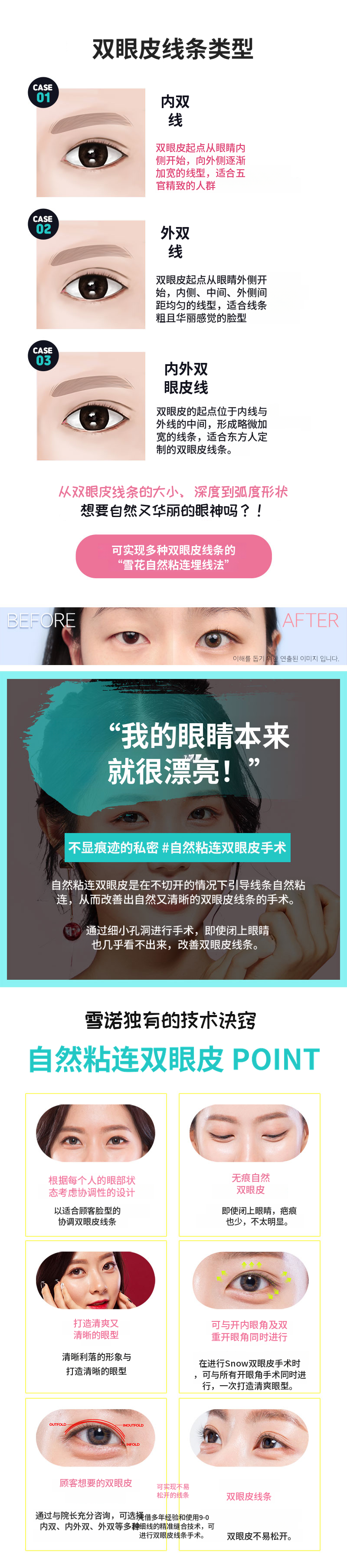 自然的自然粘合双眼皮