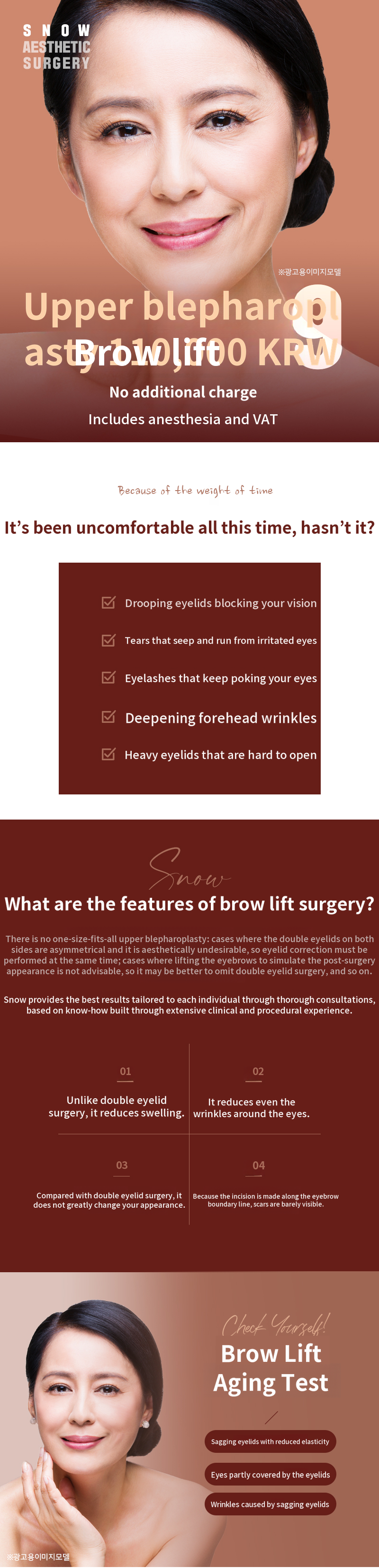 Midlife Eyelid Surgery - Upper Eyelid and Eyebrow Lift