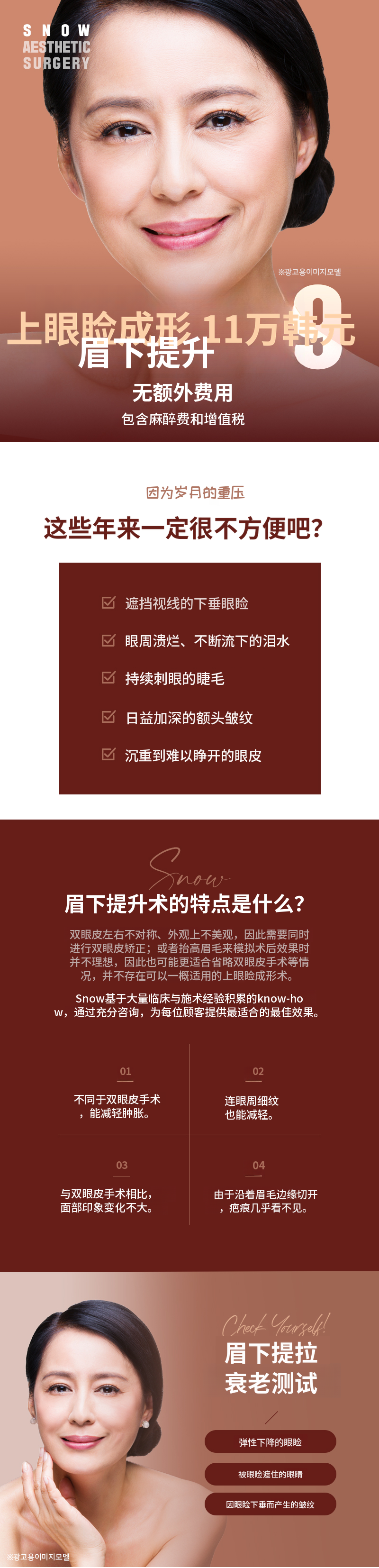 中年眼部整形 上睑眼睑手术 眉毛提升