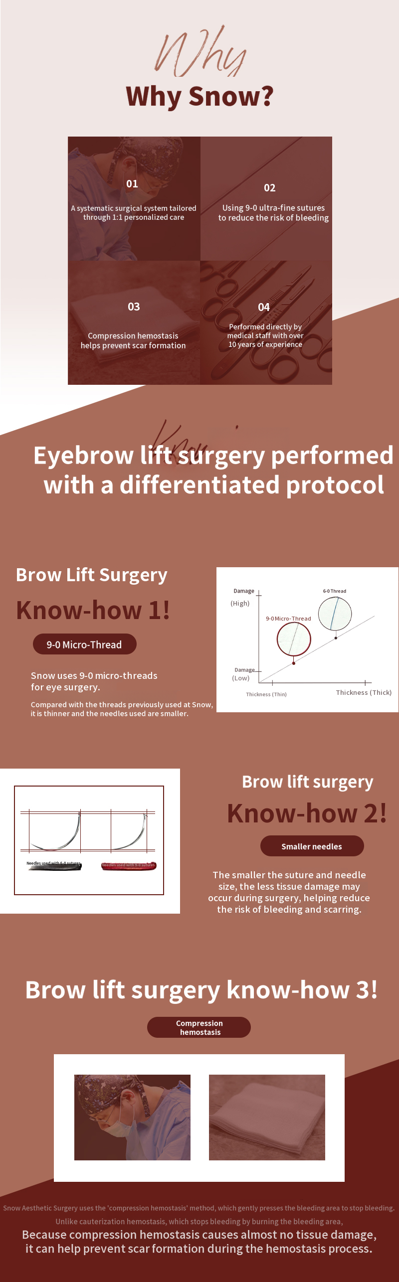 Midlife Eyelid Surgery - Upper Eyelid and Eyebrow Lift