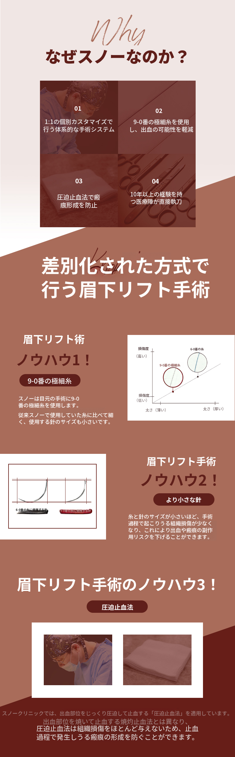 中年期まぶた形成 上眼瞼 まぶた下挙上術