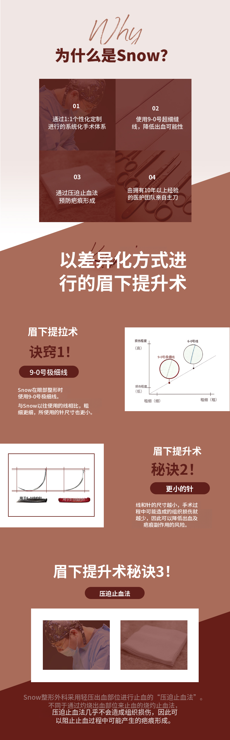 中年眼部整形 上睑眼睑手术 眉毛提升