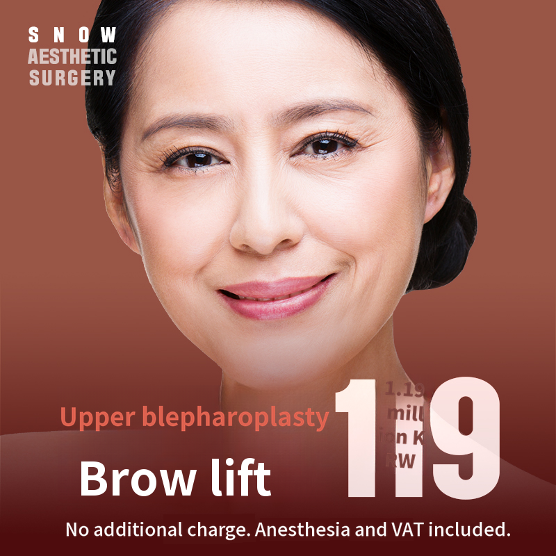 Midlife Eyelid Surgery - Upper Eyelid and Eyebrow Lift