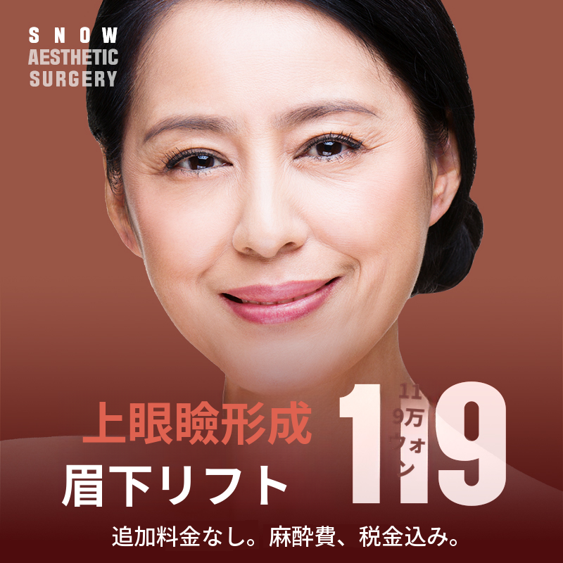 中年期まぶた形成 上眼瞼 まぶた下挙上術