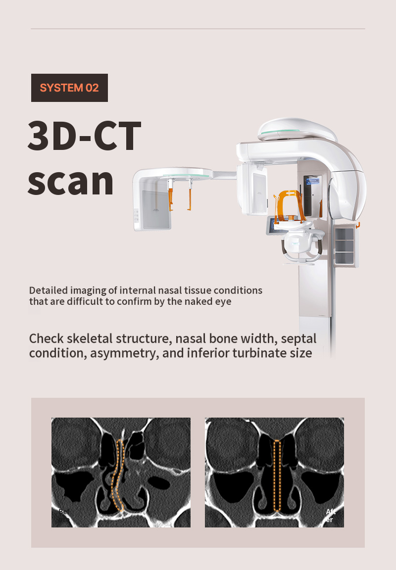 ❤️View❤️Functional Nose Surgery