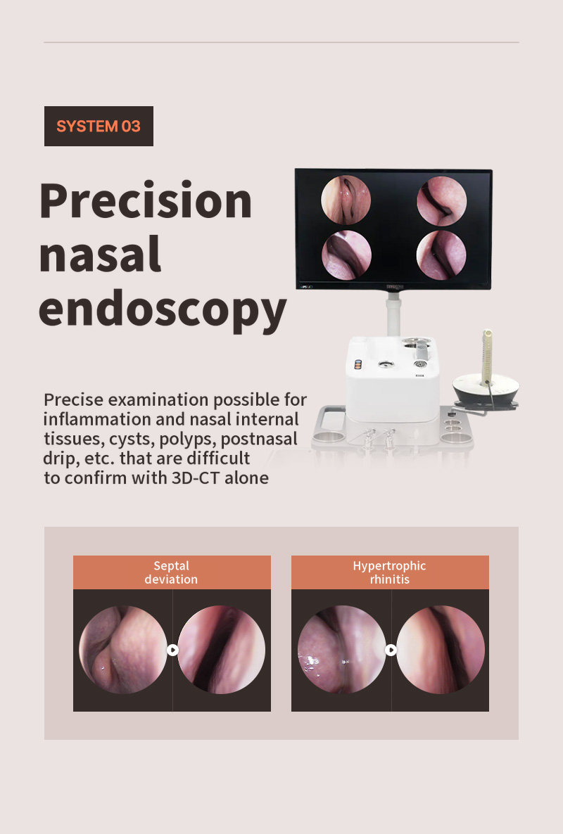 ❤️View❤️Functional Nose Surgery