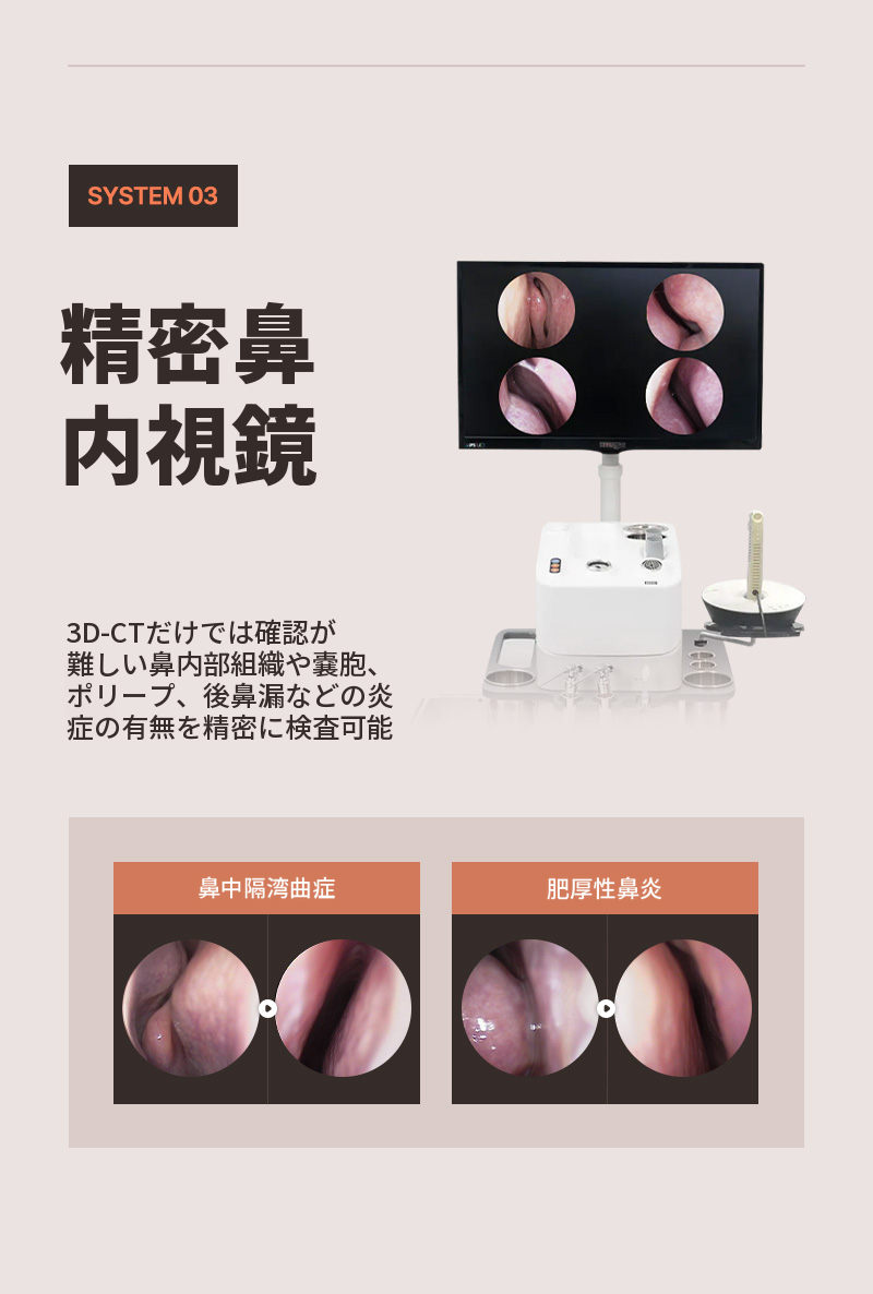 ❤️ビュー❤️機能コ成形